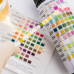10 Panel Onsite Rapid Urine Drug test