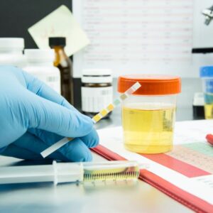 Non-DOT Urine Drug Test